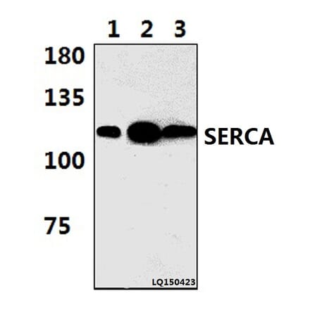 Anti-SERCA1 (D580) Antibody from Bioworld Technology (BS3934) - Antibodies.com