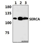 Anti-SERCA1 (D580) Antibody from Bioworld Technology (BS3934) - Antibodies.com