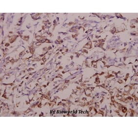 Anti-OATP1 (N286) Antibody from Bioworld Technology (BS3952) - Antibodies.com