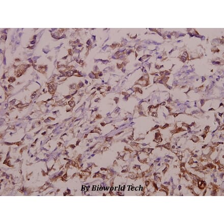 Anti-OATP1 (N286) Antibody from Bioworld Technology (BS3952) - Antibodies.com