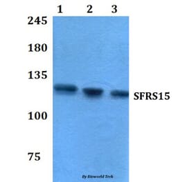 Anti-SFRS15 (V641) Antibody from Bioworld Technology (BS3953) - Antibodies.com