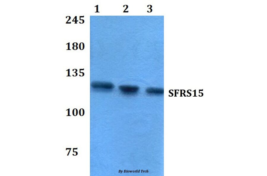 Anti-SFRS15 (V641) Antibody from Bioworld Technology (BS3953) - Antibodies.com