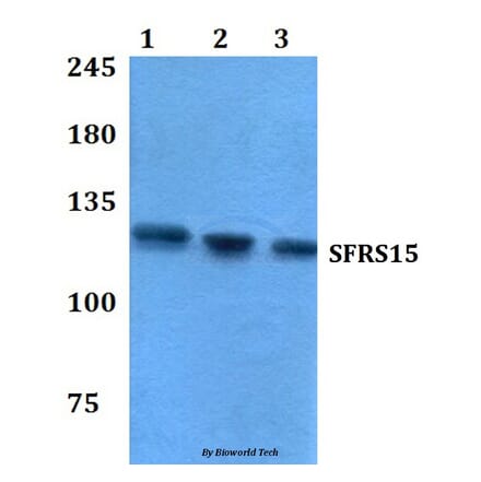Anti-SFRS15 (V641) Antibody from Bioworld Technology (BS3953) - Antibodies.com