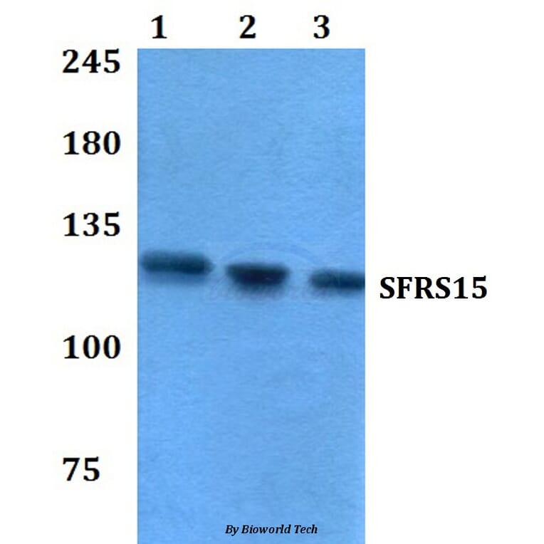 Anti-SFRS15 (V641) Antibody from Bioworld Technology (BS3953) - Antibodies.com
