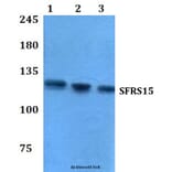 Anti-SFRS15 (V641) Antibody from Bioworld Technology (BS3953) - Antibodies.com