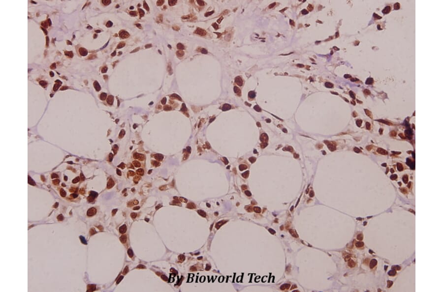 Anti-SFRS15 (V641) Antibody from Bioworld Technology (BS3953) - Antibodies.com