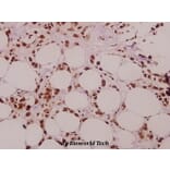 Anti-SFRS15 (V641) Antibody from Bioworld Technology (BS3953) - Antibodies.com