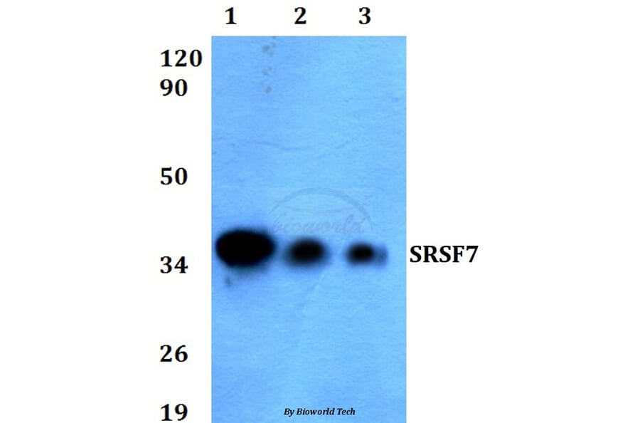Anti-SRSF7 (N103) Antibody from Bioworld Technology (BS3954) - Antibodies.com