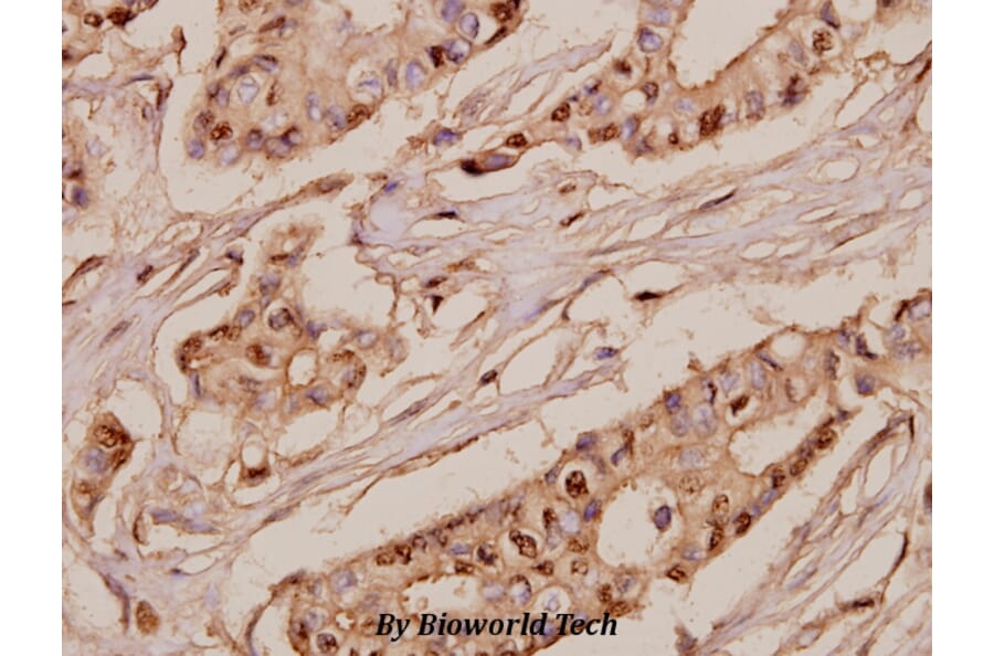 Anti-SRSF7 (N103) Antibody from Bioworld Technology (BS3954) - Antibodies.com