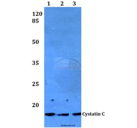 Anti-Cystatin C (F122) Antibody from Bioworld Technology (BS3973) - Antibodies.com