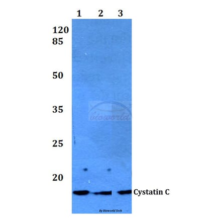 Anti-Cystatin C (F122) Antibody from Bioworld Technology (BS3973) - Antibodies.com