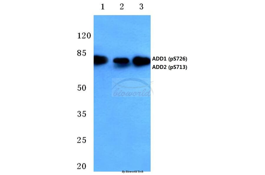 Anti-Adducin α/β Antibody from Bioworld Technology (BS4005) - Antibodies.com