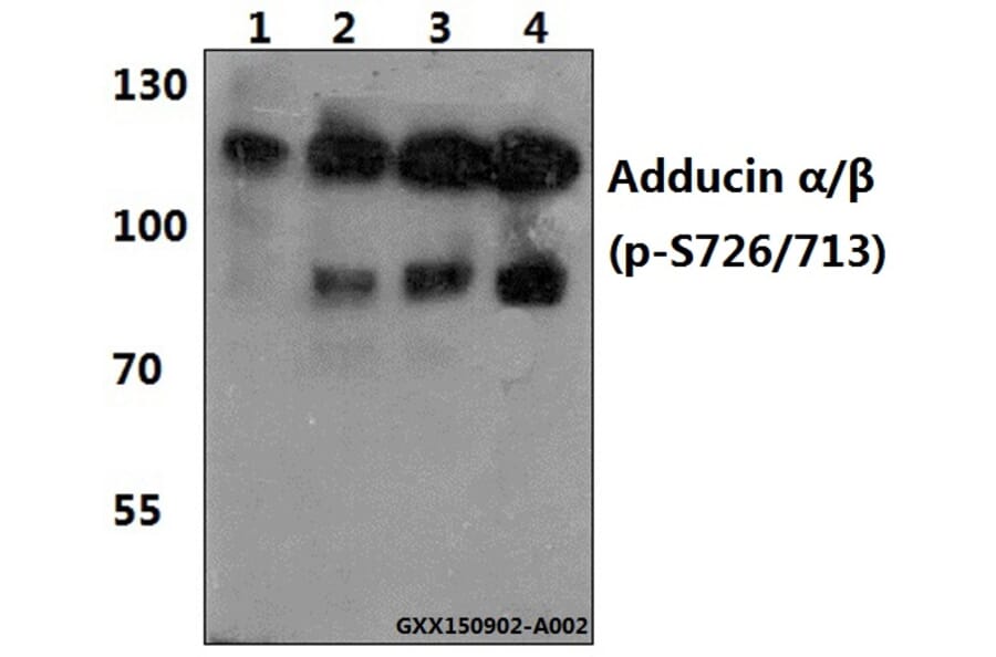 Anti-Adducin α/β Antibody from Bioworld Technology (BS4005) - Antibodies.com