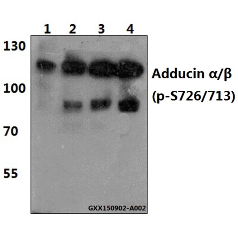 Anti-Adducin α/β Antibody from Bioworld Technology (BS4005) - Antibodies.com