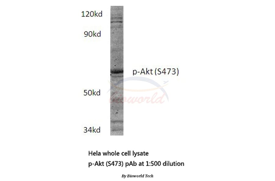 Anti-AKT (phospho-S473) Antibody from Bioworld Technology (BS4006) - Antibodies.com