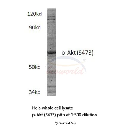 Anti-AKT (phospho-S473) Antibody from Bioworld Technology (BS4006) - Antibodies.com