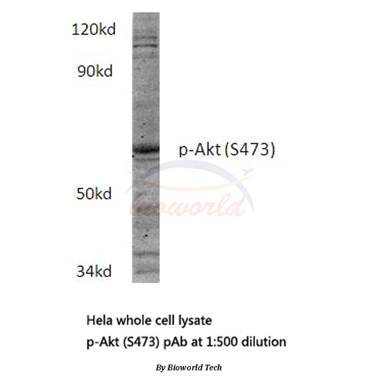 Anti-AKT (phospho-S473) Antibody from Bioworld Technology (BS4006) - Antibodies.com