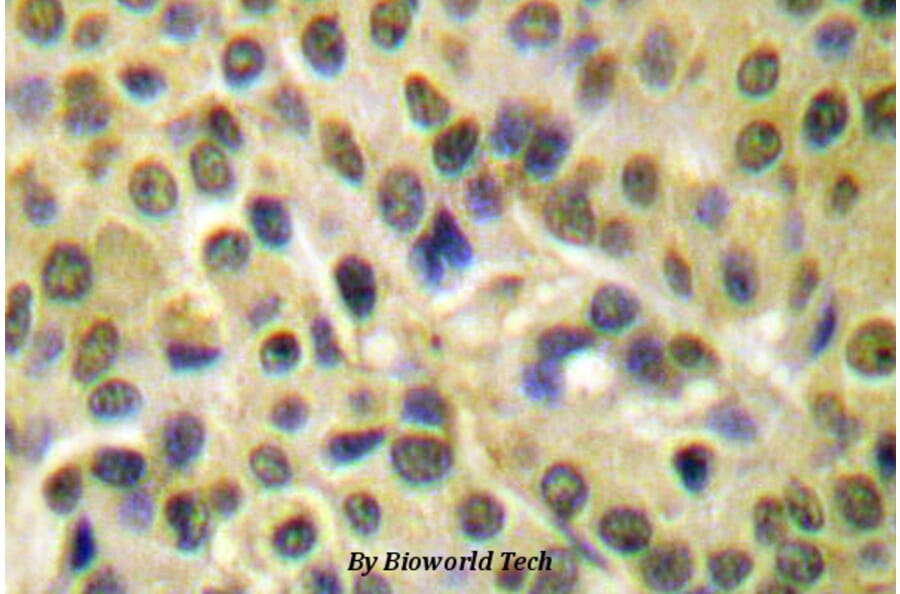 Anti-AKT (phospho-S473) Antibody from Bioworld Technology (BS4006) - Antibodies.com