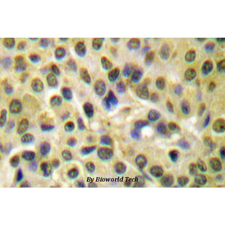 Anti-AKT (phospho-S473) Antibody from Bioworld Technology (BS4006) - Antibodies.com