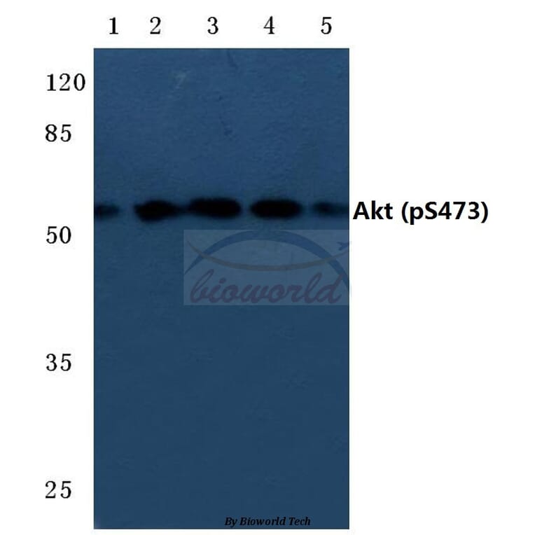 Anti-AKT (phospho-S473) Antibody from Bioworld Technology (BS4007) - Antibodies.com