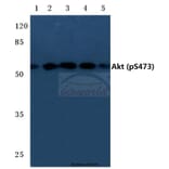 Anti-AKT (phospho-S473) Antibody from Bioworld Technology (BS4007) - Antibodies.com