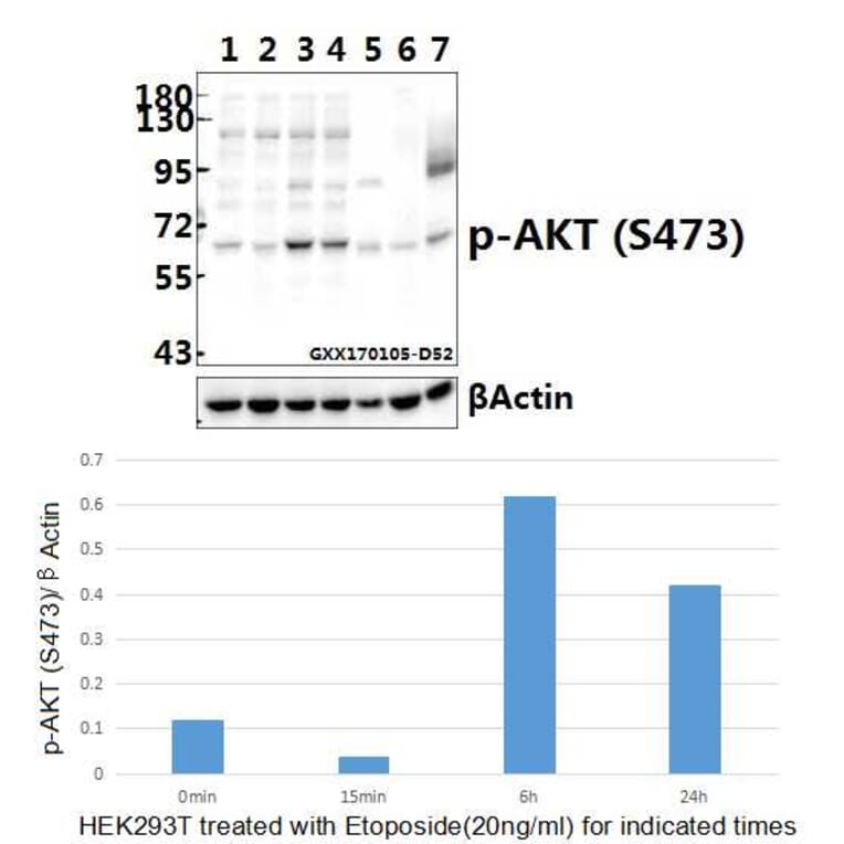 Anti-AKT (phospho-S473) Antibody from Bioworld Technology (BS4007) - Antibodies.com