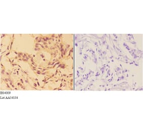 Anti-AKT (phospho-T308) Antibody from Bioworld Technology (BS4009) - Antibodies.com