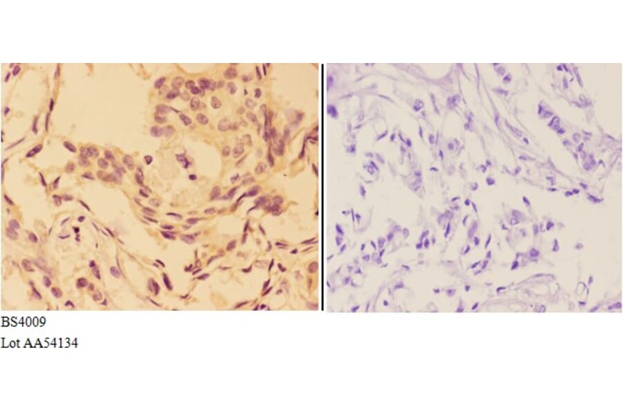 Anti-AKT (phospho-T308) Antibody from Bioworld Technology (BS4009) - Antibodies.com