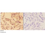 Anti-AKT (phospho-T308) Antibody from Bioworld Technology (BS4009) - Antibodies.com