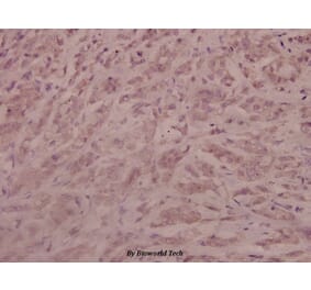 Anti-AR (phospho-S213) Antibody from Bioworld Technology (BS4011) - Antibodies.com