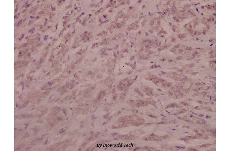 Anti-AR (phospho-S213) Antibody from Bioworld Technology (BS4011) - Antibodies.com