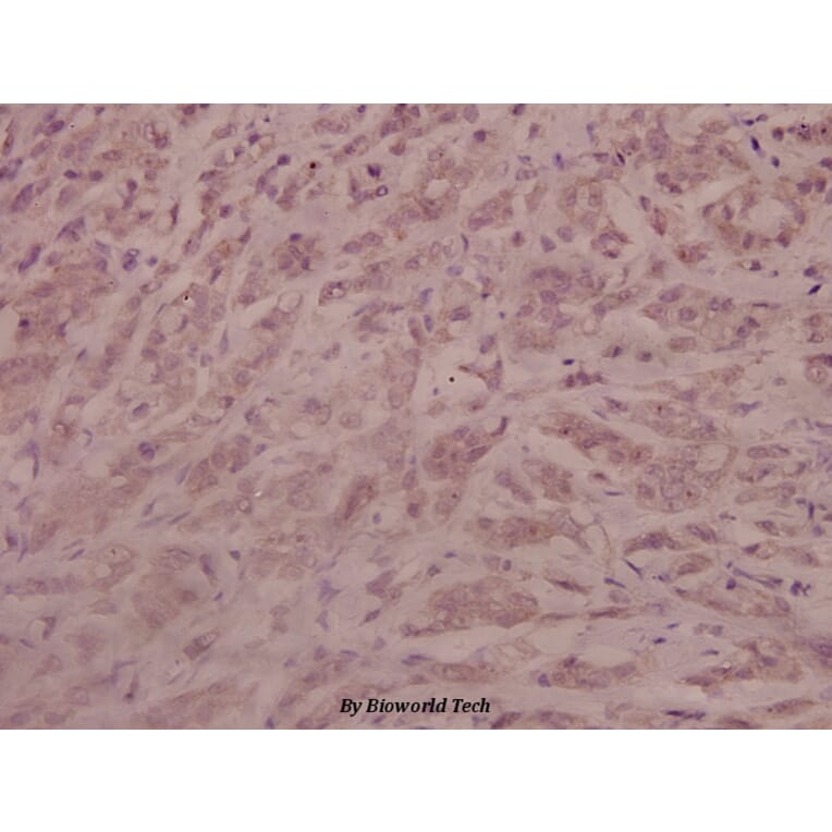 Anti-AR (phospho-S213) Antibody from Bioworld Technology (BS4011) - Antibodies.com