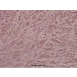 Anti-AR (phospho-S213) Antibody from Bioworld Technology (BS4011) - Antibodies.com