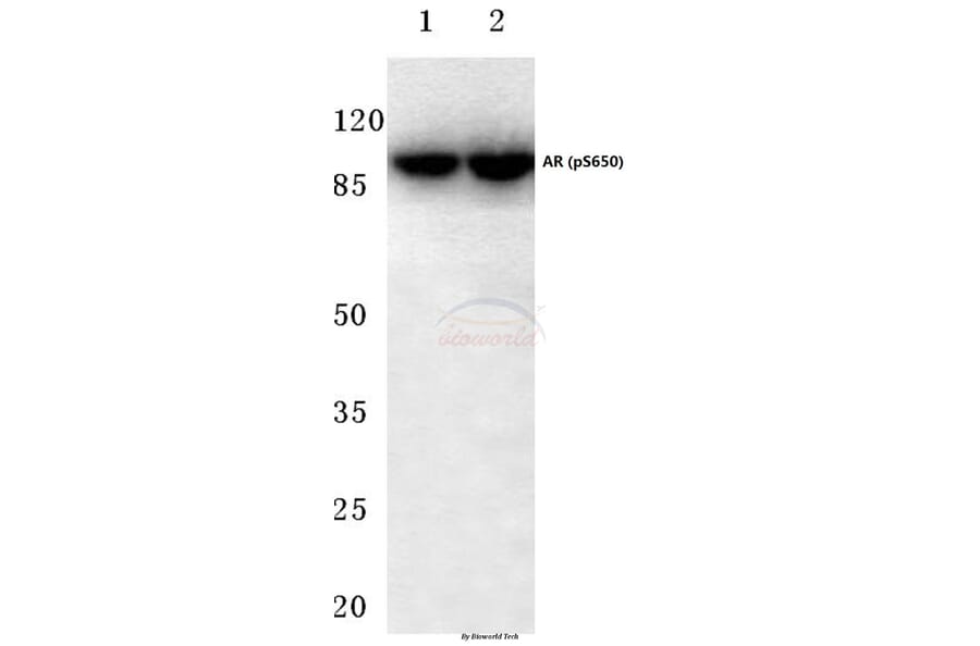 Anti-AR (phospho-S650) Antibody from Bioworld Technology (BS4012) - Antibodies.com