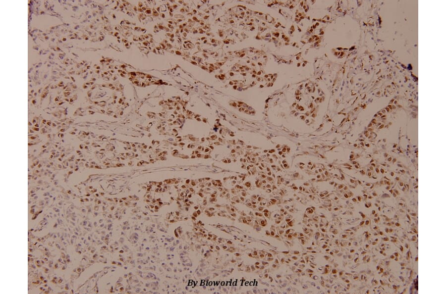 Anti-AR (phospho-S650) Antibody from Bioworld Technology (BS4012) - Antibodies.com