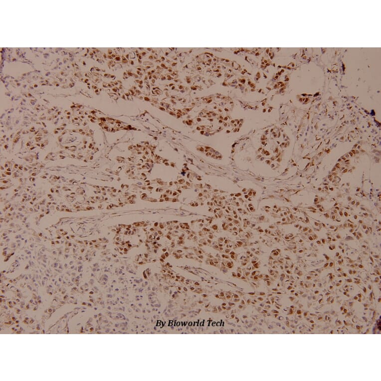 Anti-AR (phospho-S650) Antibody from Bioworld Technology (BS4012) - Antibodies.com