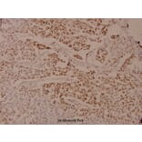 Anti-AR (phospho-S650) Antibody from Bioworld Technology (BS4012) - Antibodies.com