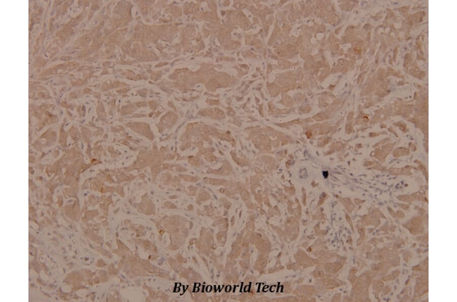 Anti-ASK1 (phospho-S83) Antibody from Bioworld Technology (BS4013) - Antibodies.com