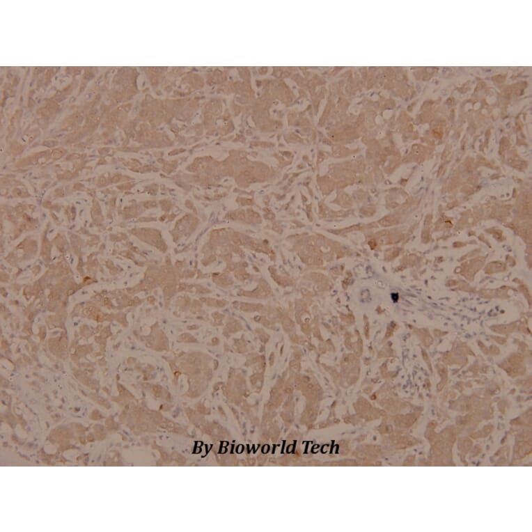 Anti-ASK1 (phospho-S83) Antibody from Bioworld Technology (BS4013) - Antibodies.com