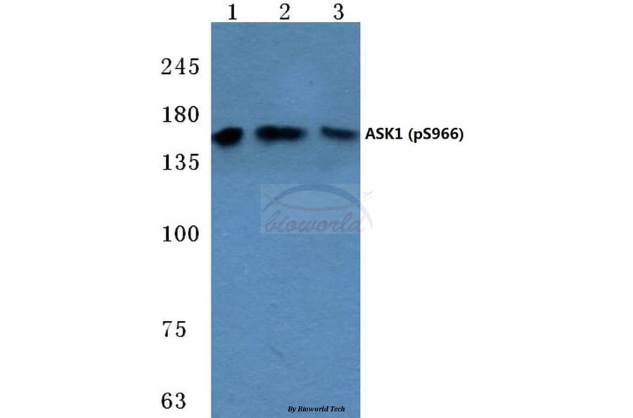 Anti-ASK1 (phospho-S966) Antibody from Bioworld Technology (BS4014) - Antibodies.com