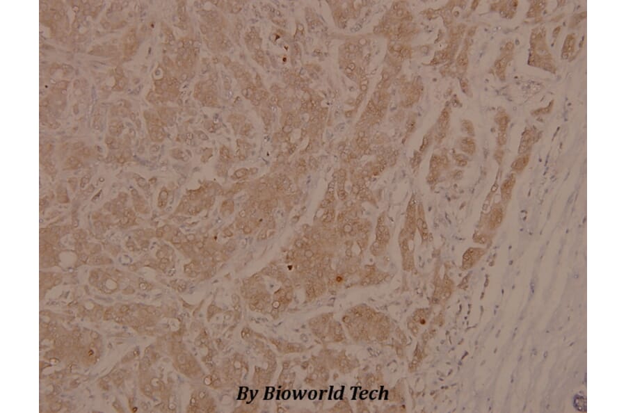 Anti-ASK1 (phospho-S966) Antibody from Bioworld Technology (BS4014) - Antibodies.com