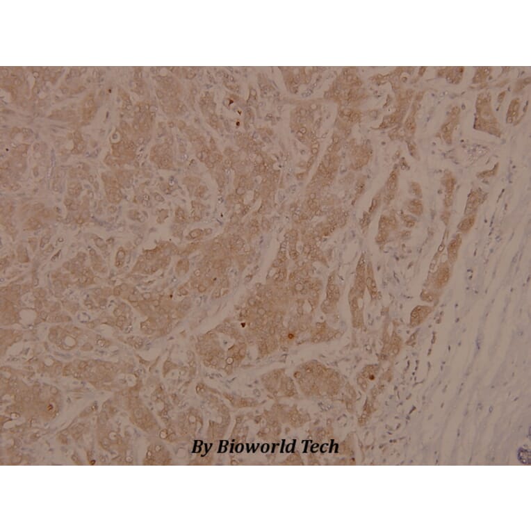 Anti-ASK1 (phospho-S966) Antibody from Bioworld Technology (BS4014) - Antibodies.com