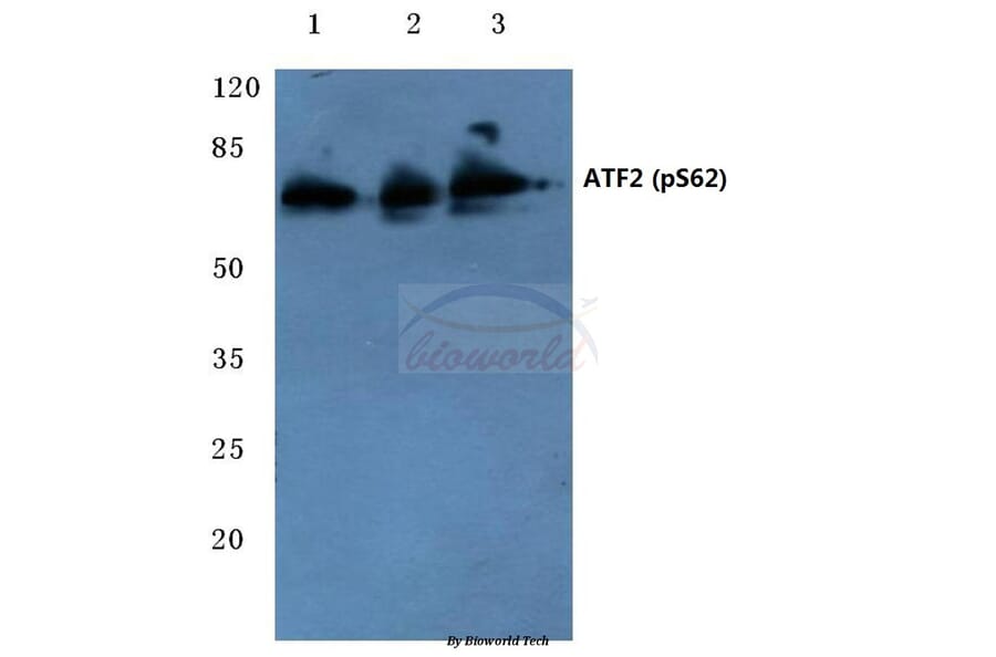 Anti-ATF2 (phospho-S62) Antibody from Bioworld Technology (BS4016) - Antibodies.com