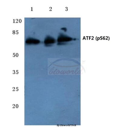 Anti-ATF2 (phospho-S62) Antibody from Bioworld Technology (BS4016) - Antibodies.com