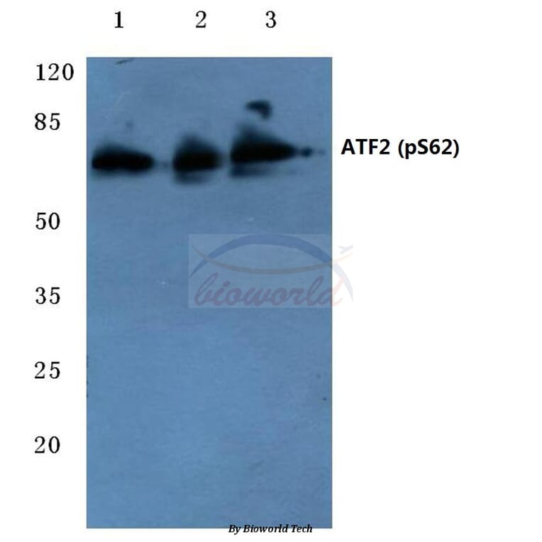 Anti-ATF2 (phospho-S62) Antibody from Bioworld Technology (BS4016) - Antibodies.com