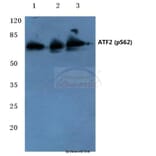 Anti-ATF2 (phospho-S62) Antibody from Bioworld Technology (BS4016) - Antibodies.com