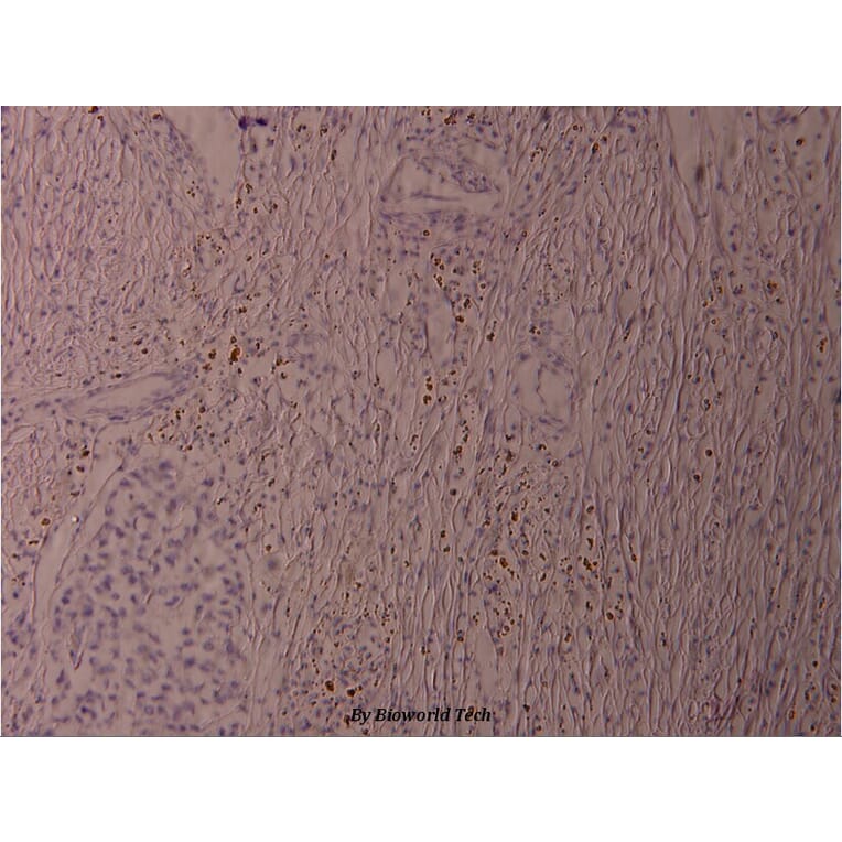 Anti-ATF2 (phospho-S62) Antibody from Bioworld Technology (BS4016) - Antibodies.com