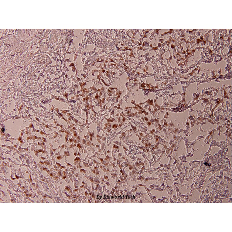 Anti-ATF2 (phospho-T69) Antibody from Bioworld Technology (BS4017) - Antibodies.com