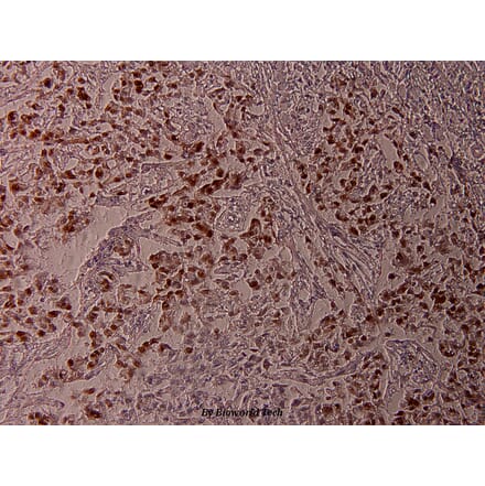 Anti-ATF2 (phospho-T71) Antibody from Bioworld Technology (BS4018) - Antibodies.com