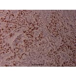 Anti-ATF2 (phospho-T71) Antibody from Bioworld Technology (BS4018) - Antibodies.com